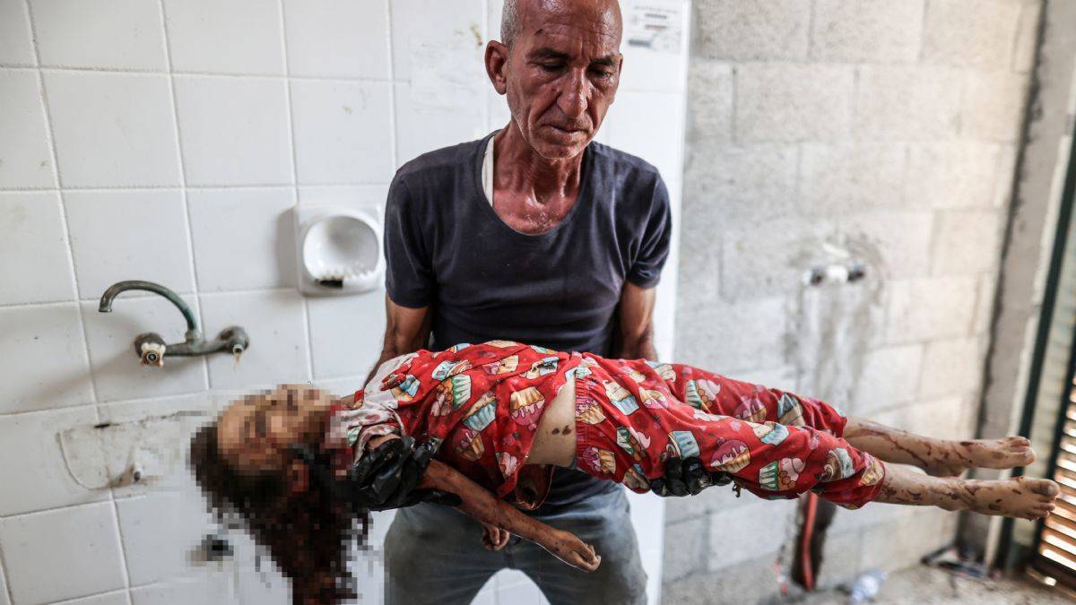 İsrail silahları tuhaf yaralar açıyor