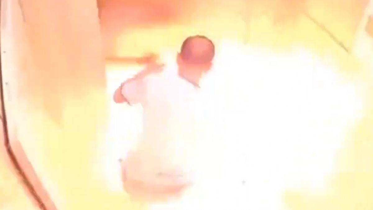 Elindeki batarya patladı, yanarak öldü