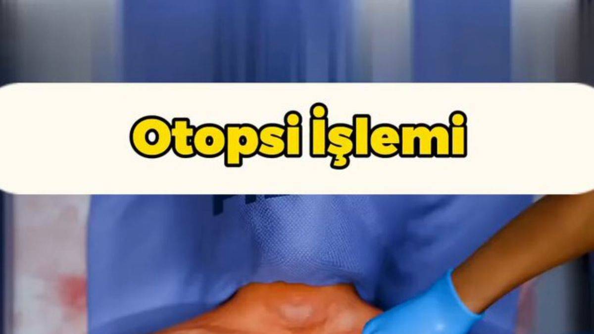 Otopsi işlemi nasıl ve ne için yapılır?