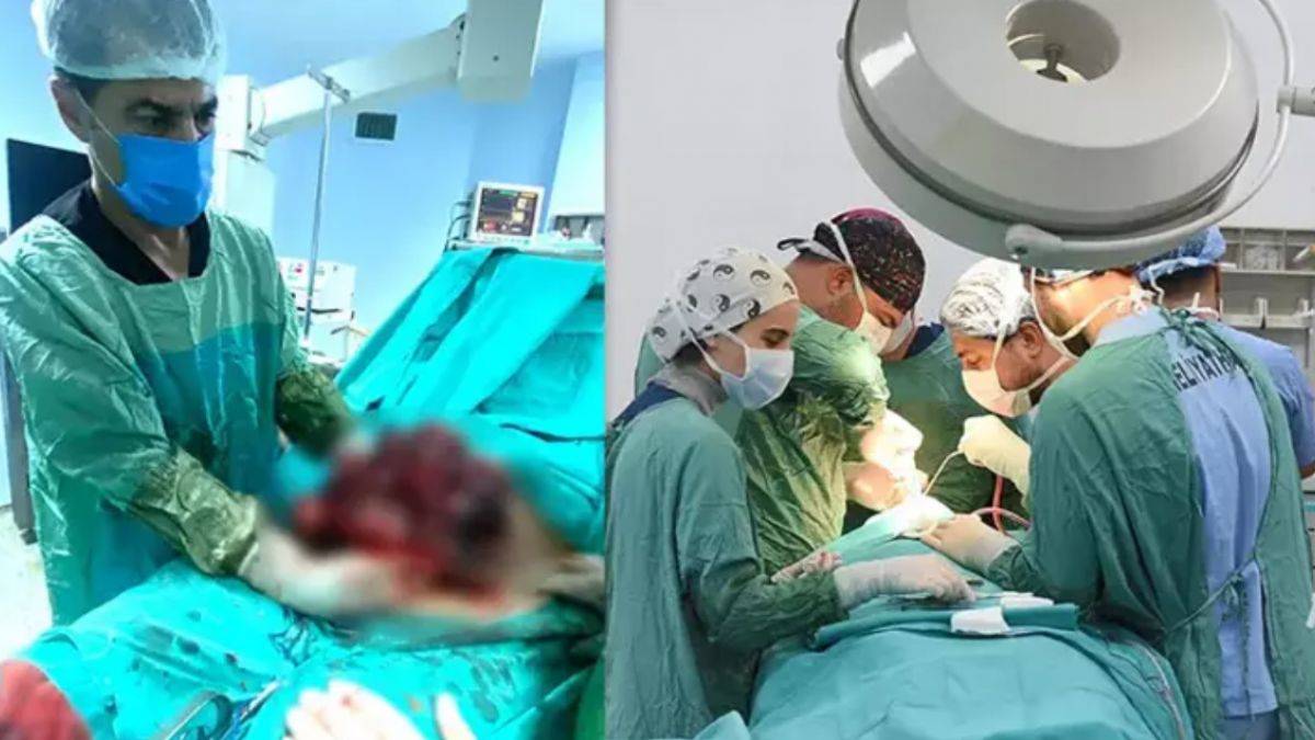 Yıllarca karnındaki 10 kiloluk kitleyle yaşamış