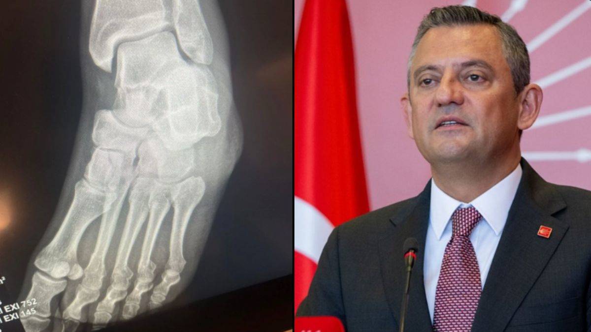 'Silahla yaralandı' iddialarına Özgür Özel'den cevap