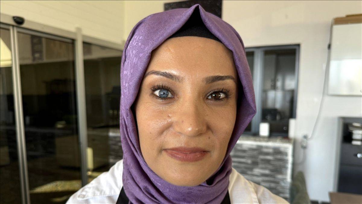 Gözlerinin biri mavi diğeri kahverengi