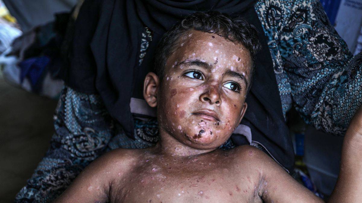 Gazze'de 325. Gün! İsrail son 24 saatte iki katliam yaptı