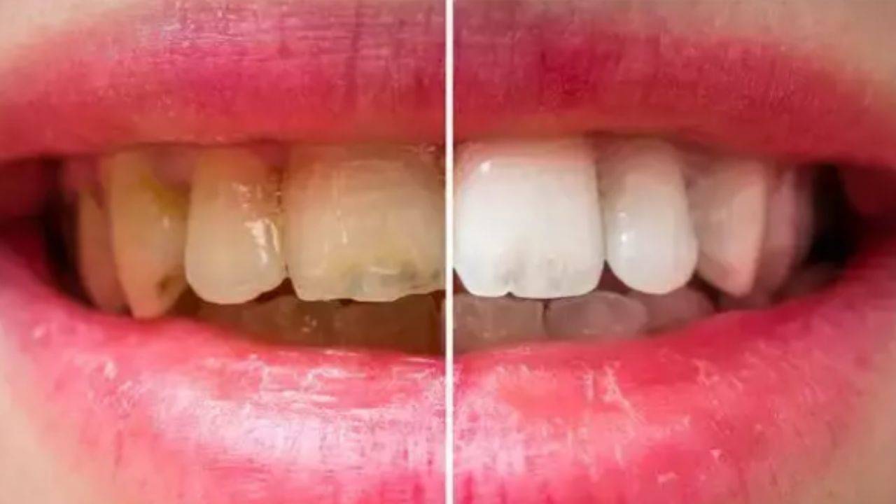 Diş sağlığınızı tehdit eden kahve hataları!