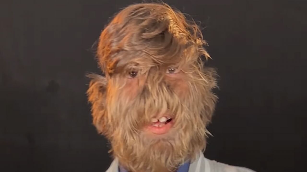 'Dünyanın en kıllı yüzüne sahip erkeği'