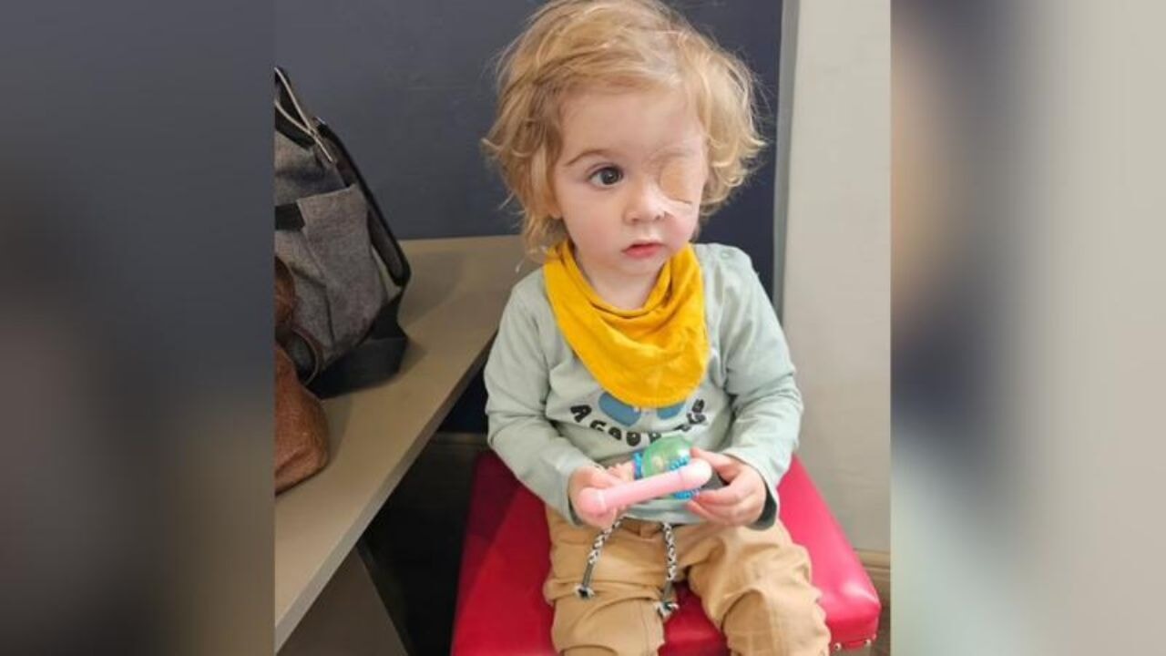 Bir öpücük verdi, bir gözünü kaybetti