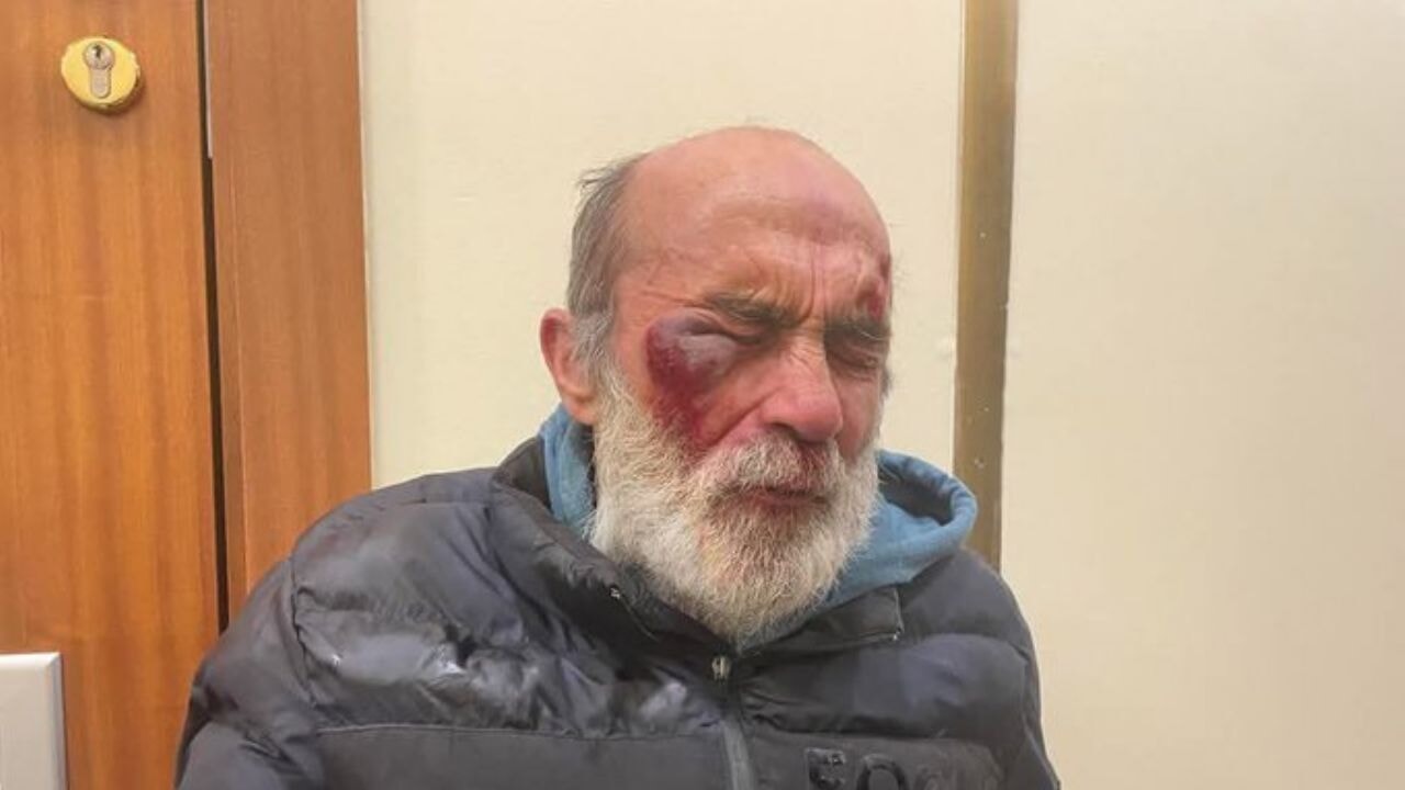 Polise asit atan saldırganın yakalandığı öne sürüldü