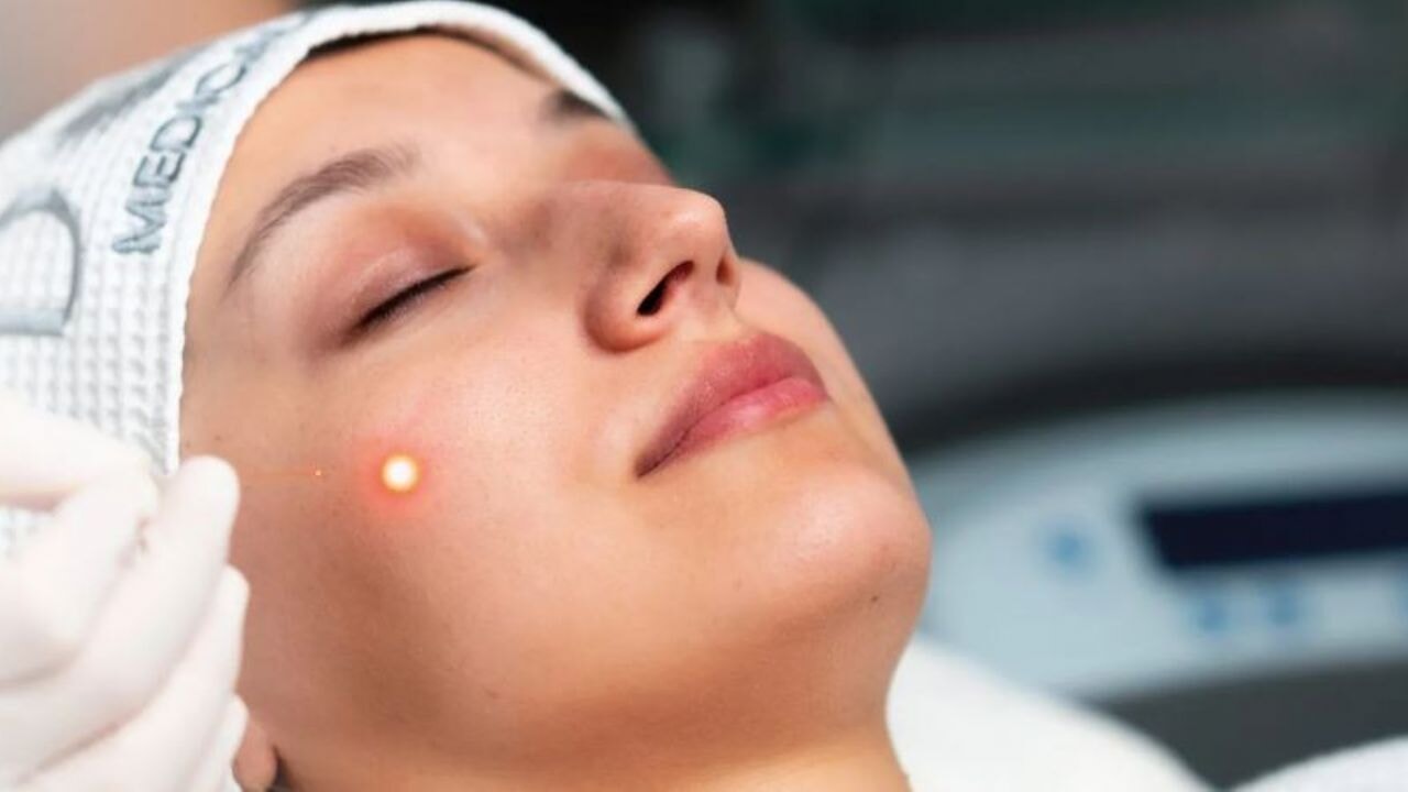 Somon DNA, Botoks ve Exosome: Cilt Gençleştirmede Üç Etkili Yöntem