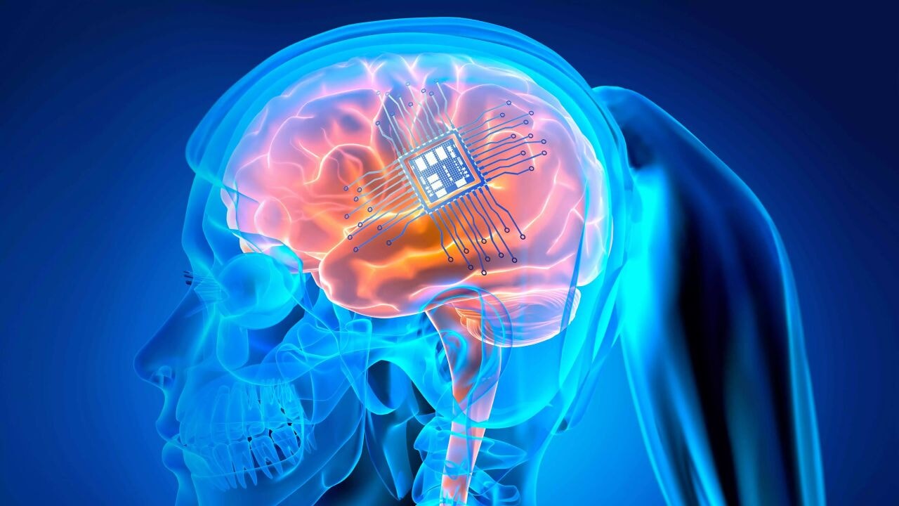 Beyin implantı, felçli kadının düşüncelerini seslendirdi!