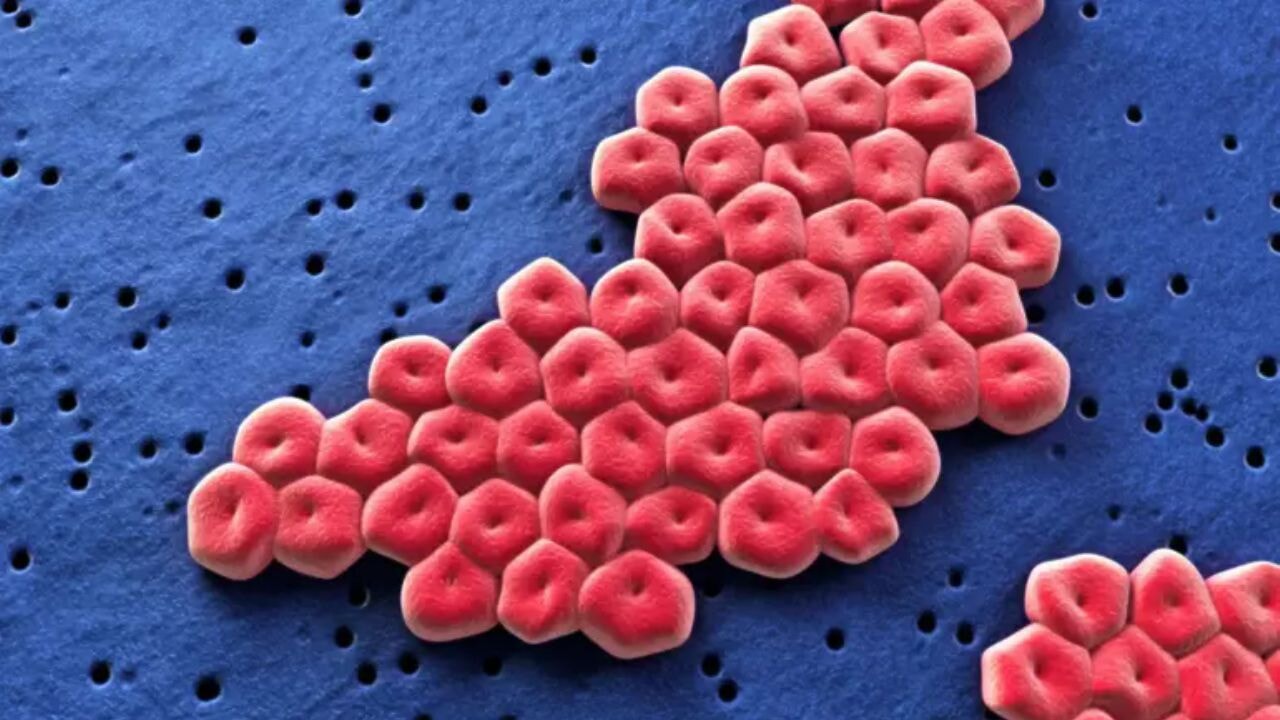 Küresel sağlık krizi kapıda: Yeni tespit edilen süper bakteri tehdidi