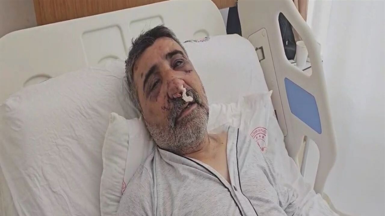 İngiliz boksörün dövdüğü taksici konuştu: Öptü, ısırdı, elini gözüme soktu