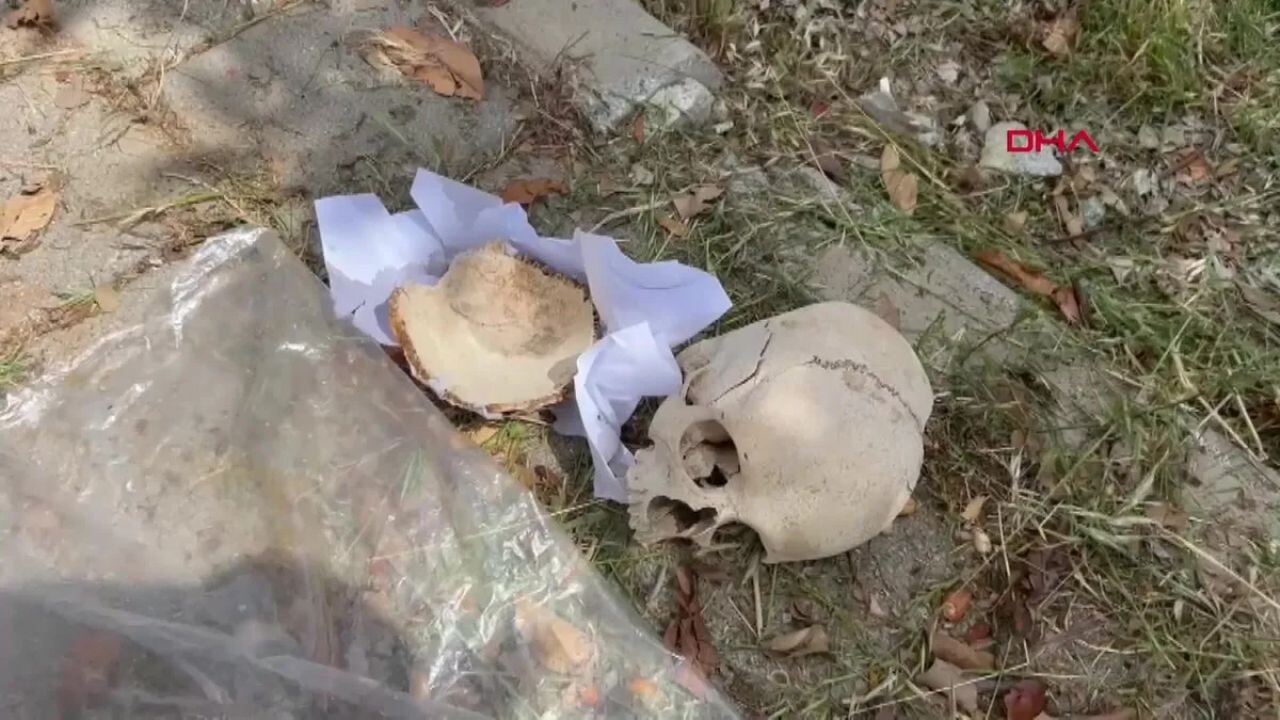Adana'da çöpte dehşet: Çocuğa ait kafatası bulundu!