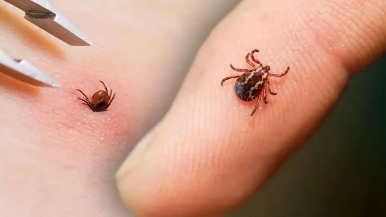 Çocukları bekleyen sessiz tehlike: Keneler gizlendiği yerden saldırıyor