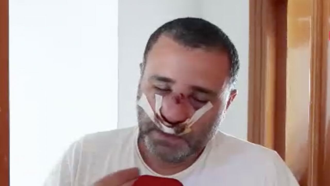 Marmaray'da çocuklarının gözü önünde darbedilen baba konuştu