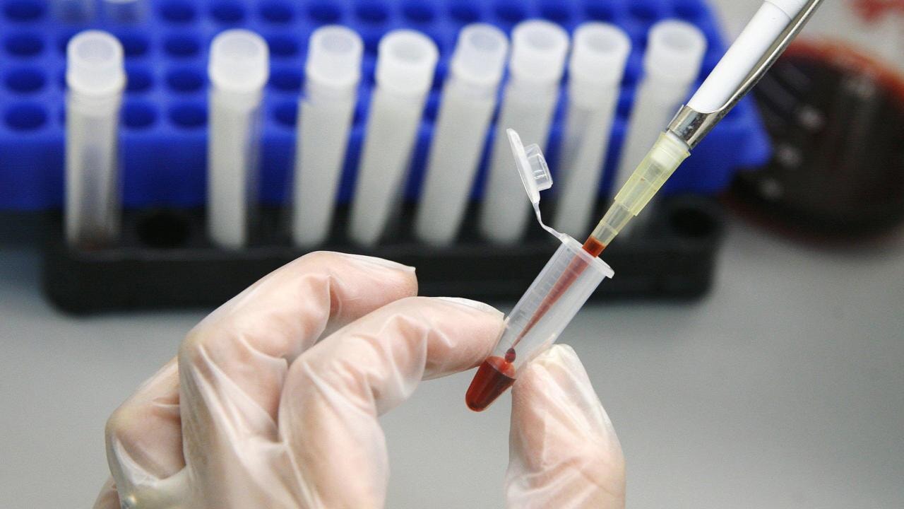 HIV tedavisinde tarihi adım: Virüs görünür hâle getirildi