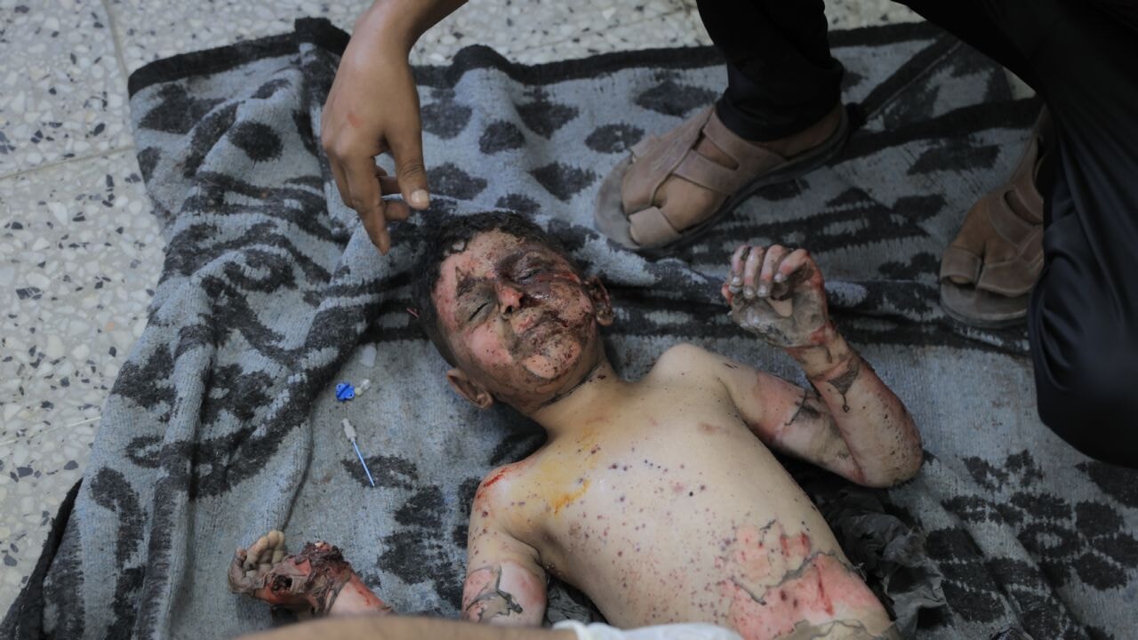 Filistinli İbrahim, Gazze'deki 'ölüm tuzağı'nı dünyaya duyuruyor