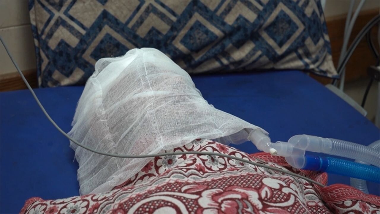 Ölüm tuzağı: Gazzeli baba yardım kuyruğunda beyninden vuruldu