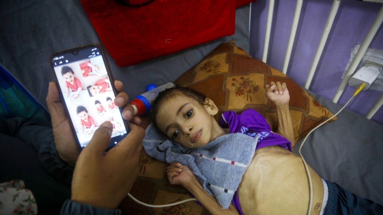 Gazzeliler açlıktan sokaklarda bayılıyor! UNRWA'dan 'İşimizi yapmamıza izin verin' çağrısı