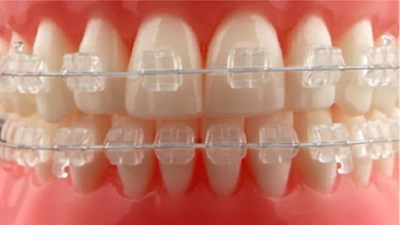 Sağlıklı Dişler, Kolay Ödeme! Alpdent'te Elden Taksit Seçeneği