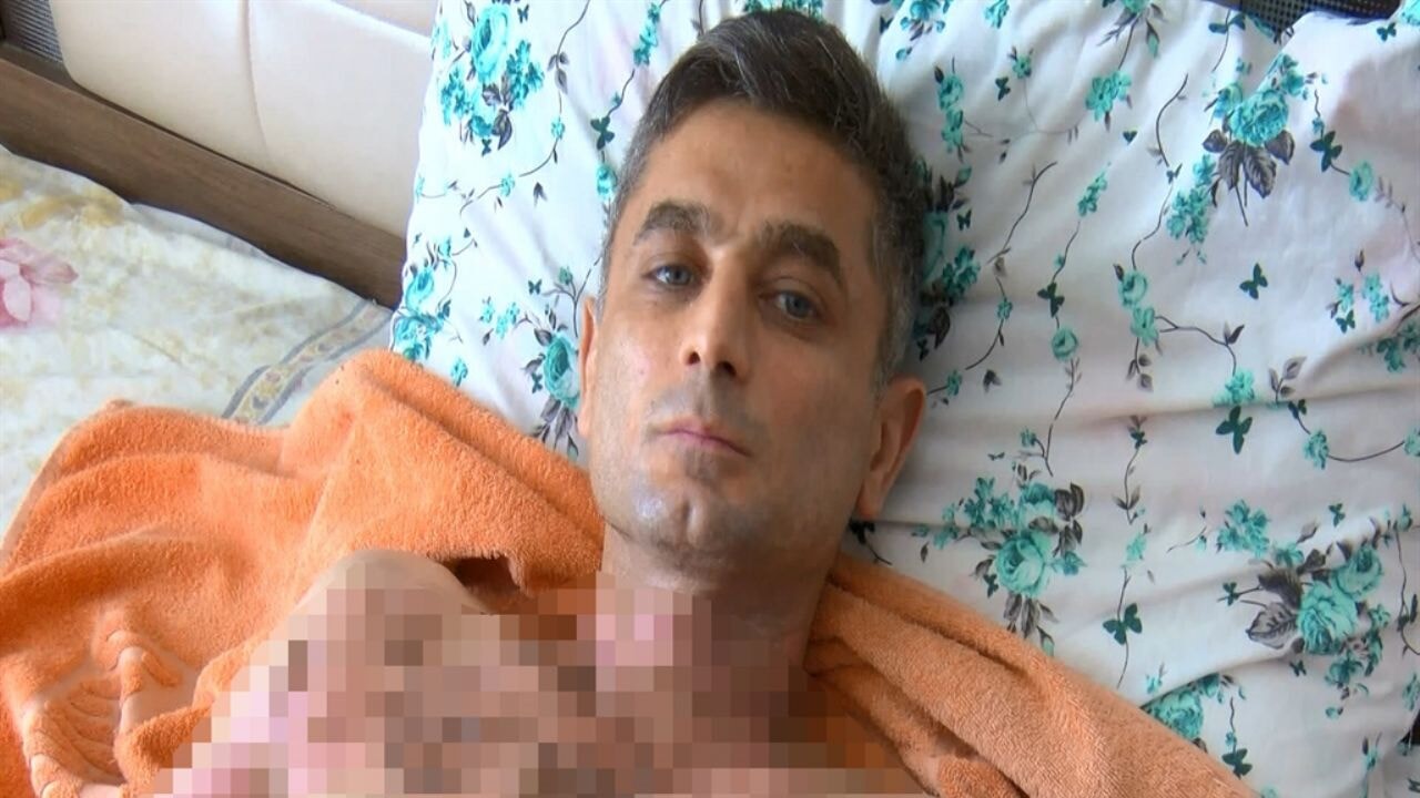 Telefonunu gasbetti, üzerine benzin dökerek yaktı!