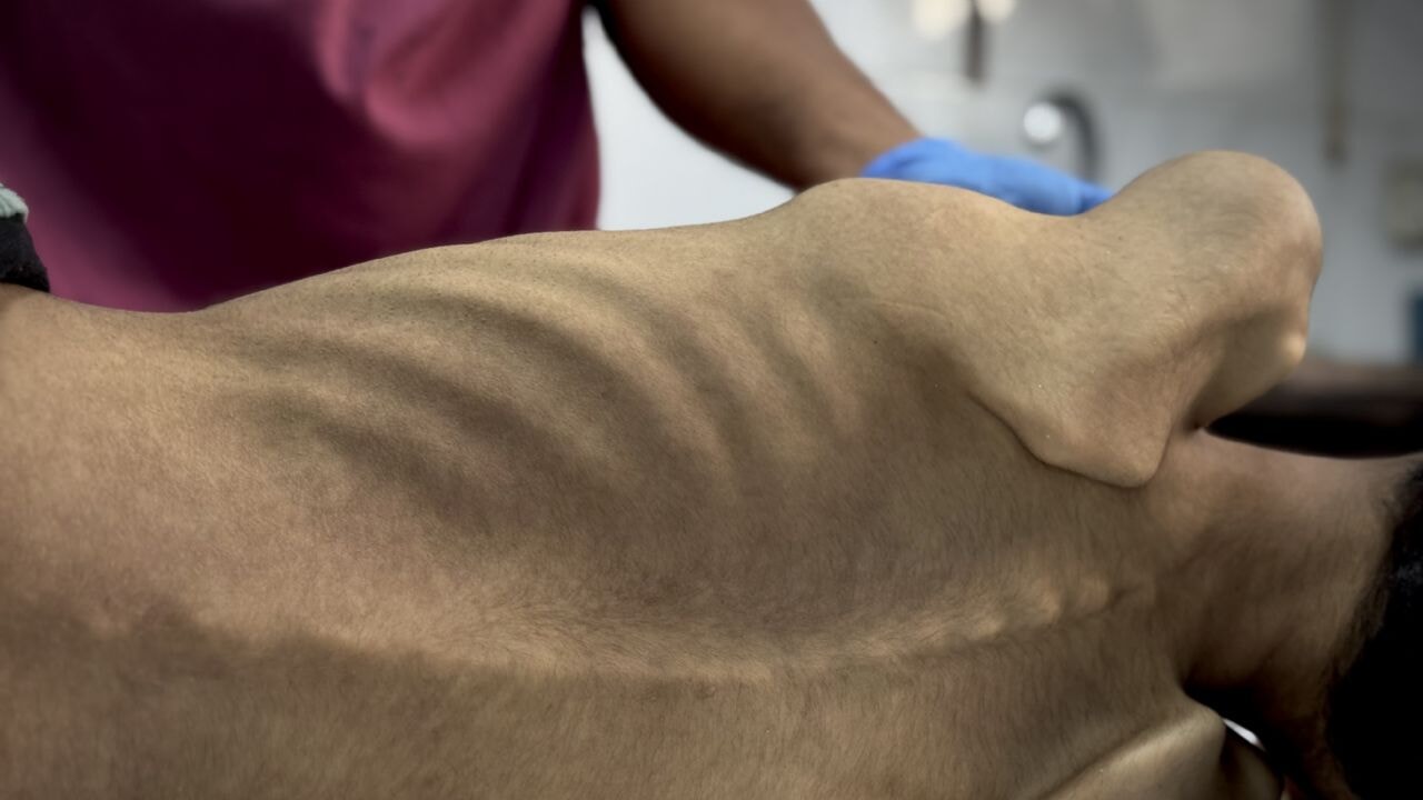 Soykırımcı İsrail inkar etti: 'Gazze'de açlık ve kıtlık yok'