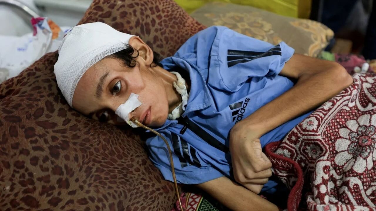 Gazze'de Açlık Krizi: Abluka Altında Yavaş İşleyen Bir 'Kıtlık Cinayeti'