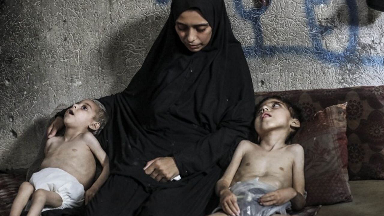 İngiliz doktor uyardı: Gazze'de açlıktan toplum ölümler olabilir