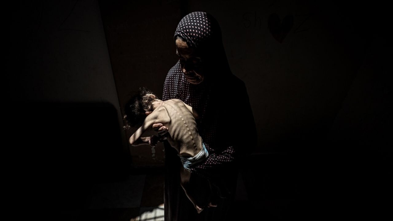 'Gazze'de Çocuklar Açlıktan Uyuyamıyor: Karınlarını Sadece Tuz ve Suyla Doyuruyorlar'