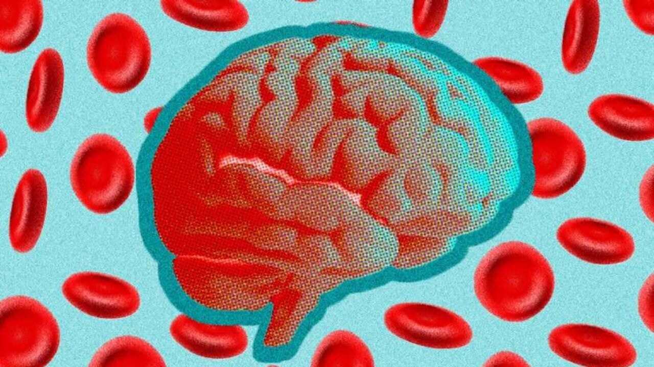 Alzheimer'ın nedeni beynin neresinde?