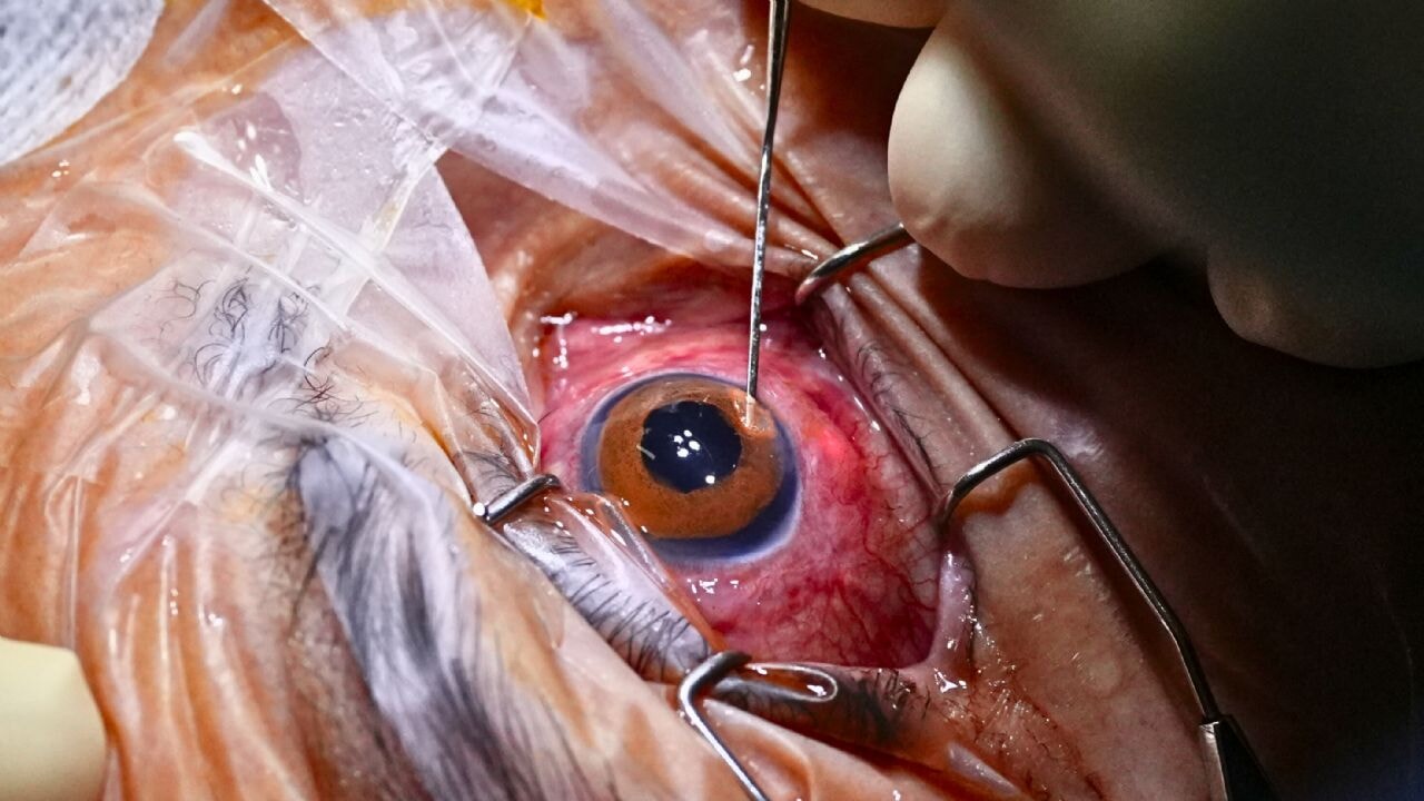 Göz dövmesi, kararan gözüne ışık oldu!