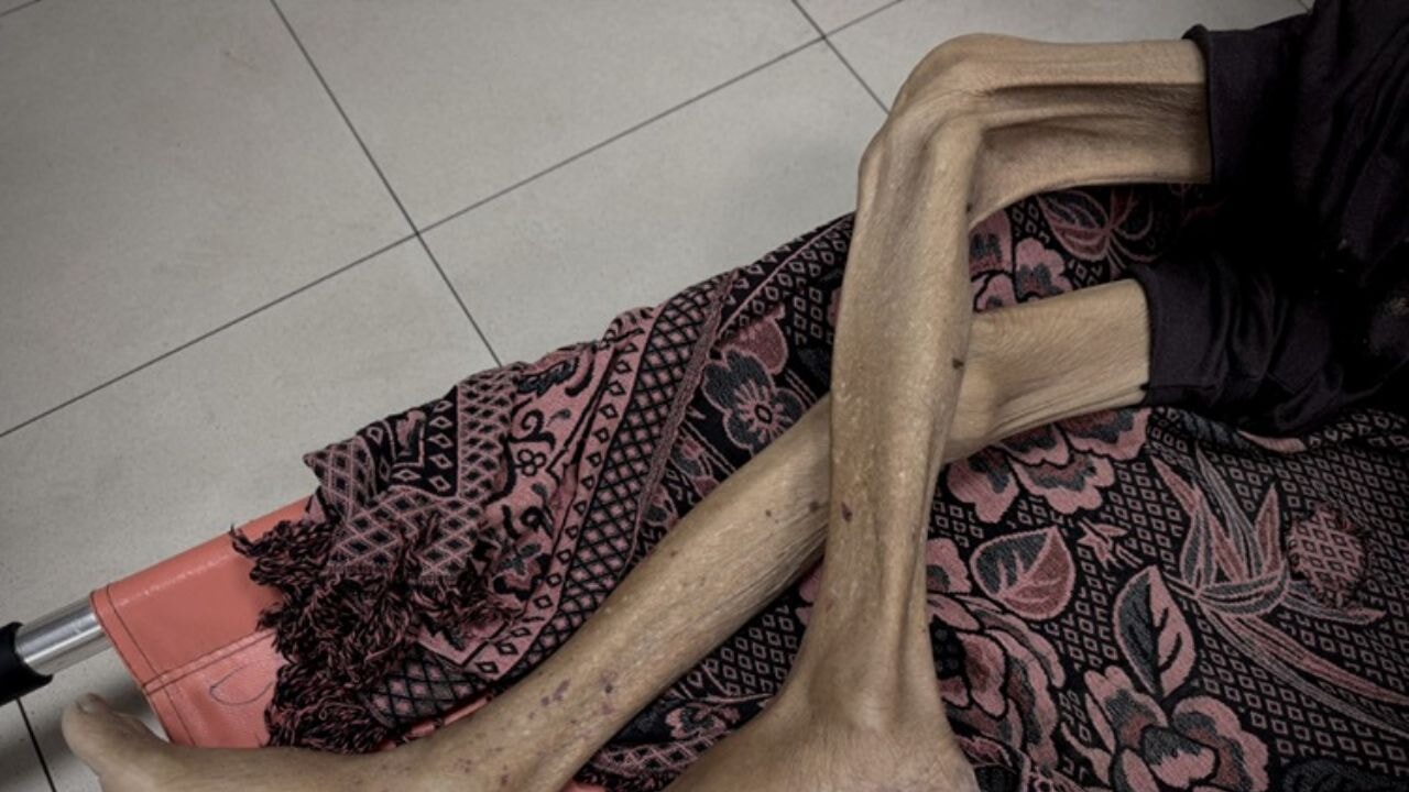 İsrail'in 'ölüm mühendisliği' bilançosu ağırlaşıyor