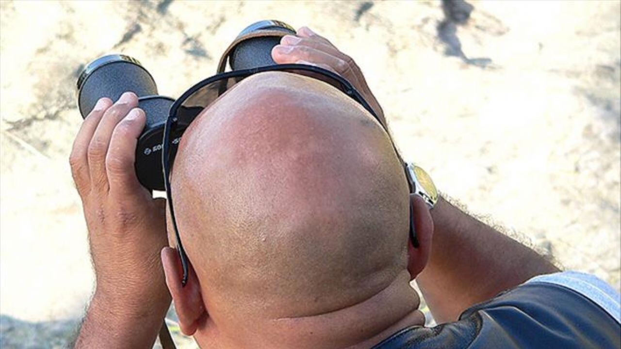 İki içecek saç dökülmesi ve erken beyazlamayı tetikliyor