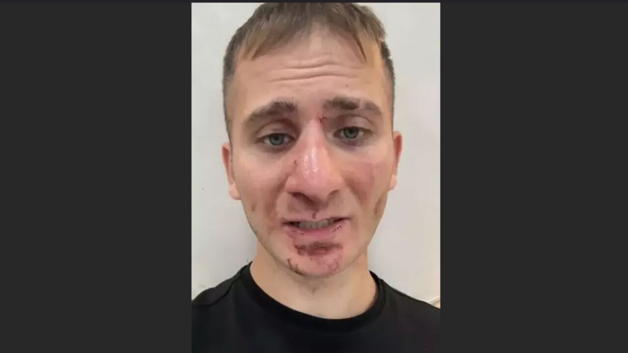 Ekvador'da saldırıya uğrayan Türk vatandaşı hakkında açıklama