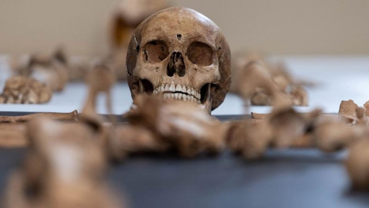 Üniversitenin 25 yıl boyunca beden parçaları topladığı ortaya çıktı