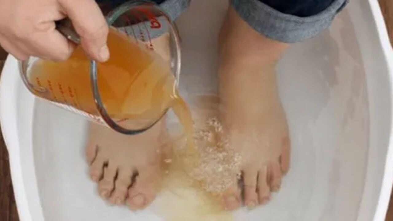 Ayak mantarı ve nasıra sirke ile alternatif bakım! İşte yapmanız gereken kolay uygulama