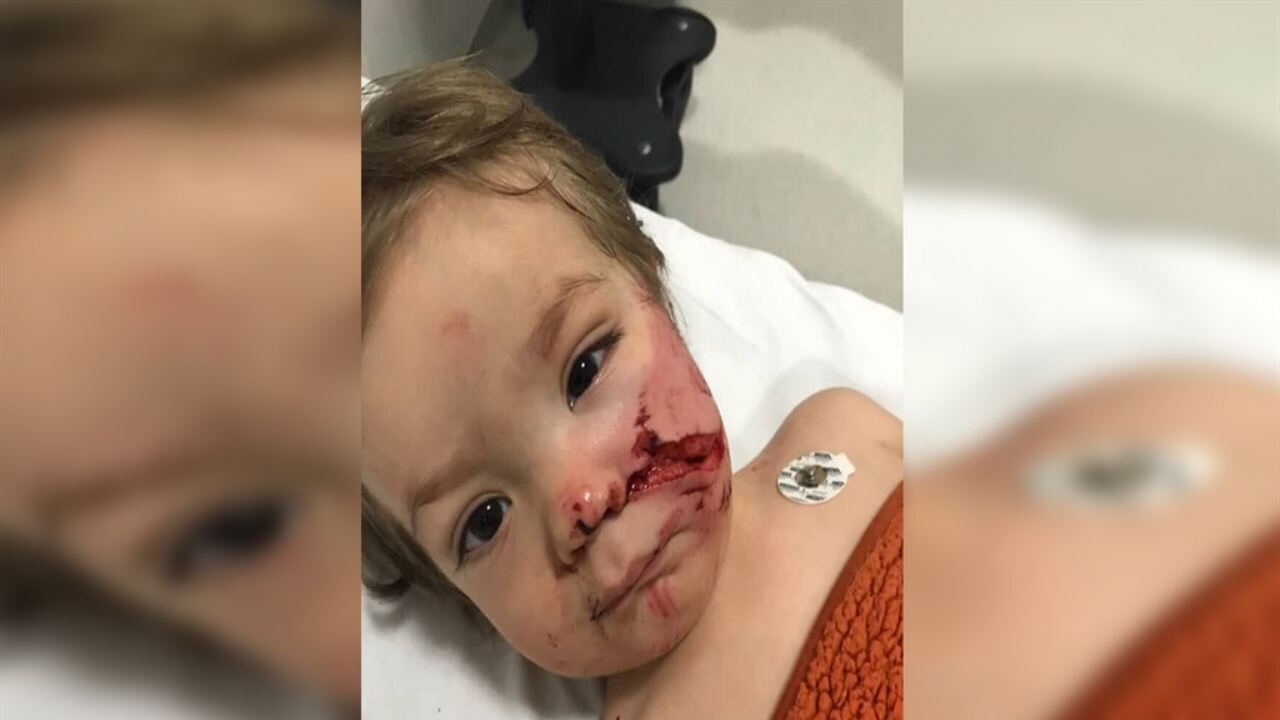 Pitbull saldırısında iki çocuk yaralandı: '12 şikayet varmış...'