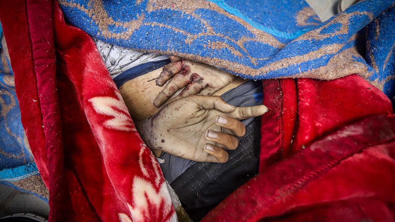 Lancet: Gazze'de can kaybı bildirilenden çok daha yüksek