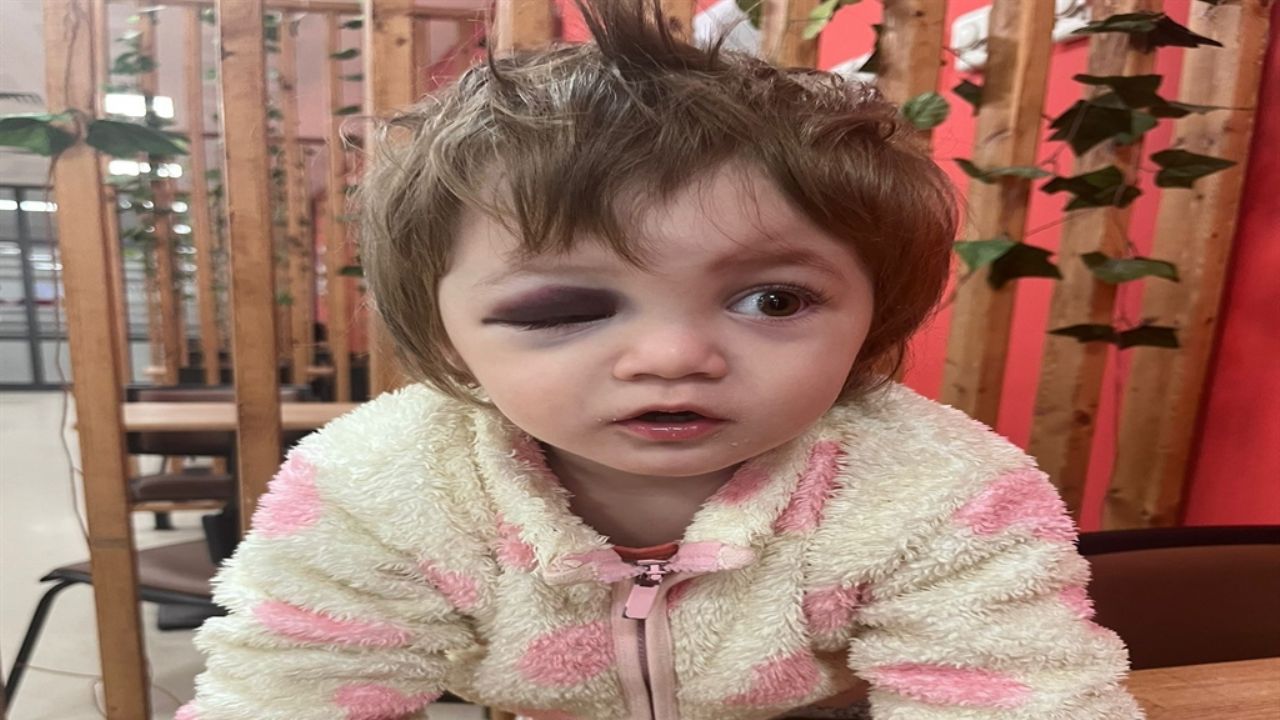 14 aylık bebeğin darbedildiği olayda şüphelilerin ifadesi ortaya çıktı