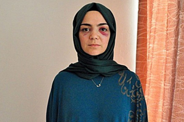 Almanya'da Müslüman kadını yumruklayan saldırgan Rus çıktı