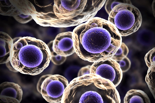 Türk doktordan kanser için önemli adım