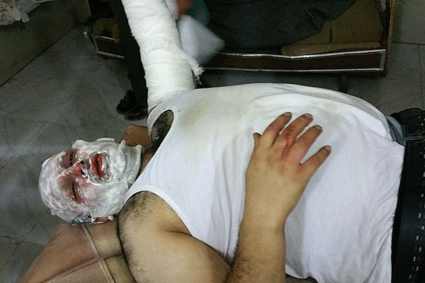 Muhabir, Esed güçlerinin füzesiyle yaralandı