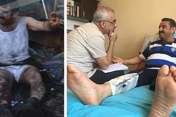 Diyarbakır mitinginde yaralanan Özcan konuştu