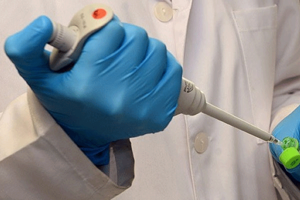 BM: 2030'da AIDS tarih olabilir