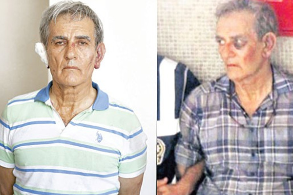 Akın Öztürk'ün yüzündeki izler dikkat çekti