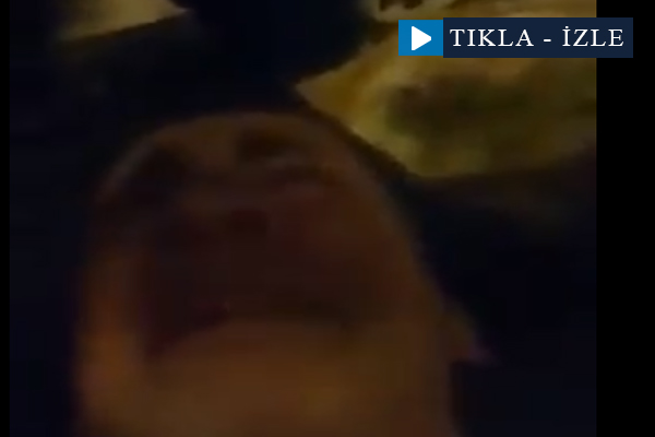 Cumhurbaşkanı darbeye direnişte yaralanan vatandaşı alnından öptü