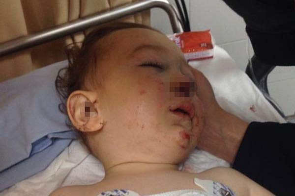 Ankara'da bebek 3'üncü katta düştü