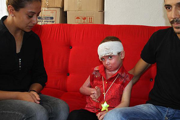 Patlayan trafo hayatını kabusa çevirdi