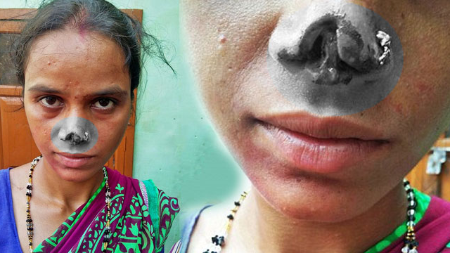 Karısının burnunu kesti