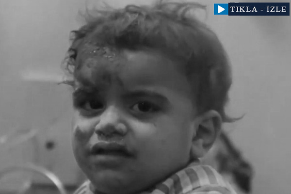 Esed ve Rus jetlerinin vurduğu Halep'in 'yaralı çocukları'