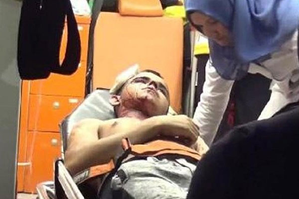 Suriyeli genci bıçakladılar